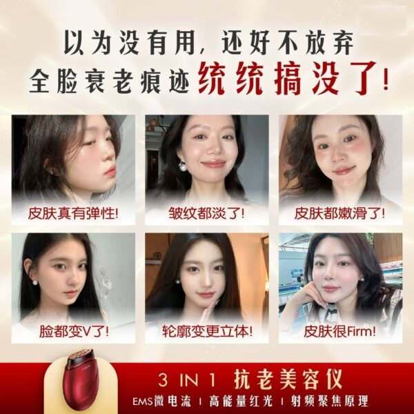 CEUDERM CD-417 (V2) 3IN1 (RF, EMS, RED LIGHT) SWIFT LIFT BEAUTY ENHANCEMENT DEVICE